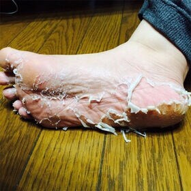 【初回限定】かかとどうスルん！そうスルんDX×3 ローズの香り