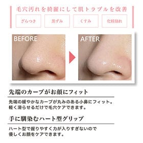 【マカロンピンク】U-ni角栓クリーナー