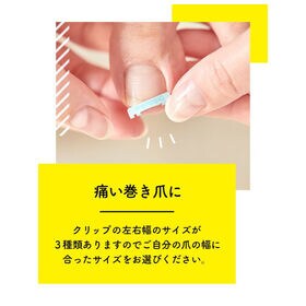 【Sサイズ・1個入】ドクターショール 巻き爪用クリップ