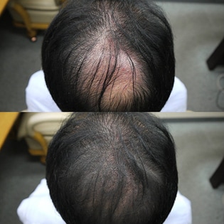 リラブスキャルプファンデーションを税込 送料込でお試し サンプル百貨店 株式会社ハーベストジャパン