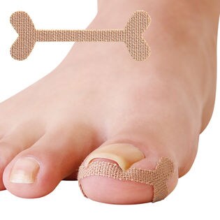 【100枚入り】巻き爪用ケアテープ